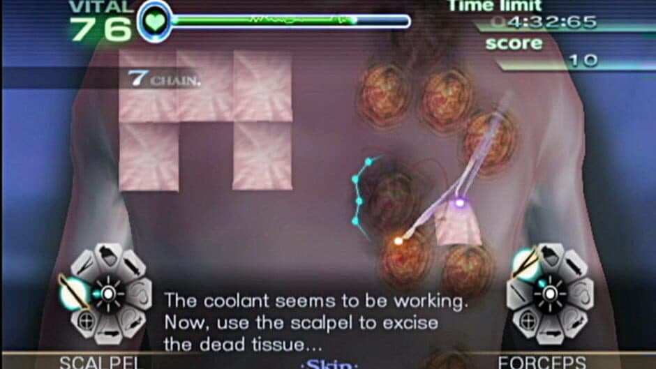 Trauma Center: New Blood screenshot 9